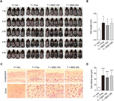 Millet seed oil activates β–catenin signaling and promotes hair growth